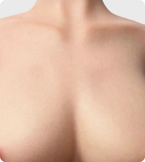 Natural
